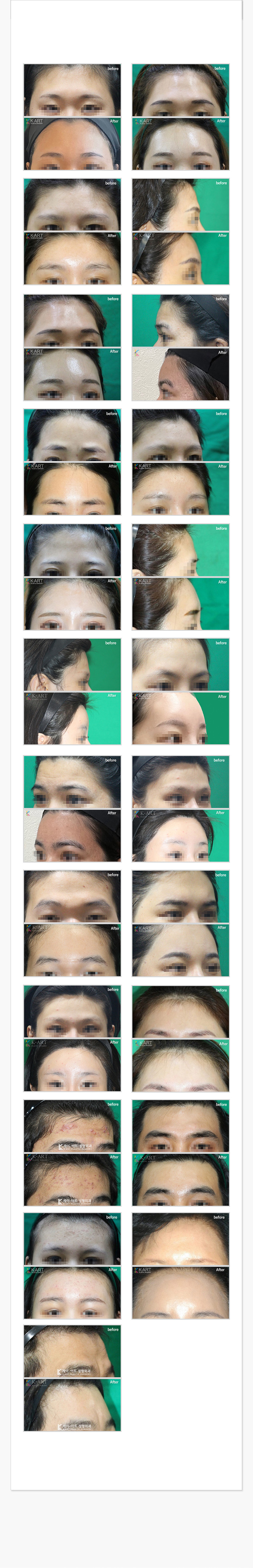 【裁断済み】外傷形成外科 Emergency Plastic Surgery 裁断済み】外傷形成外科 Emergency Plastic Surgery - メルカリ