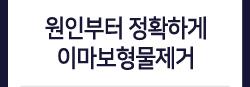 원인부터 정확하게 이마보형물제거
